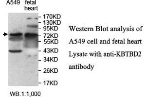 Image no. 1 for anti-Kelch Repeat and BTB (POZ) Domain Containing 2 (KBTBD2) antibody (ABIN1577433) (KBTBD2 anticorps)