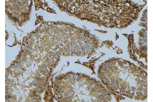 ABIN6275477 at 1/100 staining Mouse testis tissue by IHC-P. (RGS1 anticorps  (Internal Region))