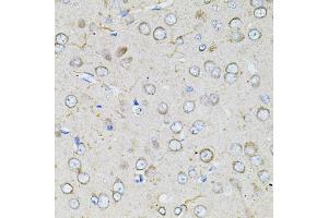 Immunohistochemistry of paraffin-embedded rat brain using BEST1 antibody (ABIN4903043) at dilution of 1:100 (40x lens). (Bestrophin 1 anticorps)