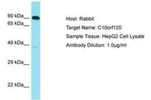 Image no. 1 for anti-Chromosome 10 Open Reading Frame 120 (C10ORF120) (AA 223-272) antibody (ABIN6750814) (C10ORF120 anticorps  (AA 223-272))