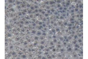 IHC-P analysis of Rat Liver Tissue, with DAB staining. (AGT anticorps)