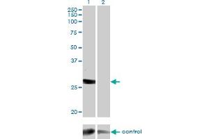 Western blot analysis of DGUOK over-expressed 293 cell line, cotransfected with DGUOK Validated Chimera RNAi (Lane 2) or non-transfected control (Lane 1). (Deoxyguanosine Kinase anticorps  (AA 1-89))