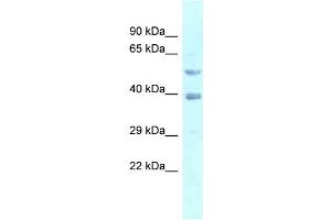 WB Suggested Anti-FEN1 Antibody Titration: 1. (FEN1 anticorps  (N-Term))
