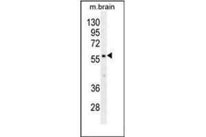 Western blot analysis of PDE1B Antibody (C-term) in mouse brain tissue lysates (35ug/lane). (PDE1B anticorps  (C-Term))