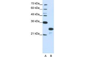 WB Suggested Anti-ANP32A Antibody Titration:  1. (PHAP1 anticorps  (N-Term))