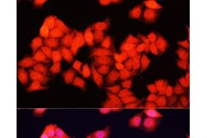 Immunofluorescence analysis of HeLa cells using ARAF Polyclonal Antibody at dilution of 1:100. (ARAF anticorps)