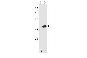 Western blot analysis of AKR1B1 using rabbit polyclonal AKR1B1 Antibody using 293 cell lysates (2 ug/lane) either nontransfected (Lane 1) or transiently transfected (Lane 2) with the AKR1B1 gene. (AKR1B1 anticorps  (AA 102-135))