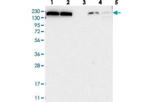 Western blot analysis of Lane 1: RT-4, Lane 2: U-251 MG, Lane 3: Human Plasma, Lane 4: Liver, Lane 5: Tonsil with KIAA1462 polyclonal antibody  at 1:250-1:500 dilution. (JCAD/KIAA1462 anticorps)