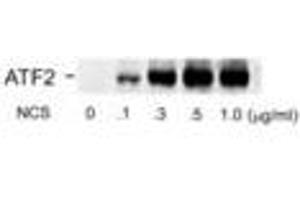 Image no. 1 for anti-Activating Transcription Factor 2 (ATF2) (pSer490), (Ser498) antibody (ABIN228488)
