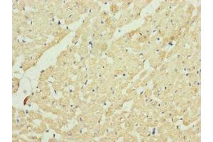 Immunohistochemistry of paraffin-embedded human heart tissue using ABIN7149107 at dilution of 1:100