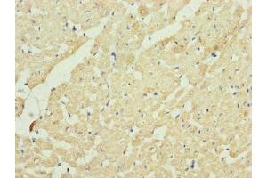 Immunohistochemistry of paraffin-embedded human heart tissue using ABIN7149107 at dilution of 1:100 (UQCRC2 anticorps  (AA 224-453))