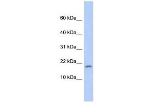 anti-Ribosomal Protein S15 (RPS15) (Middle Region) antibody
