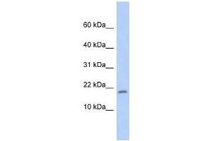 RPS15 antibody used at 1 ug/ml to detect target protein. (RPS15 anticorps  (Middle Region))