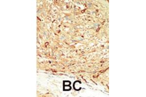 Immunohistochemistry (IHC) image for anti-Macrophage Stimulating 1 (Hepatocyte Growth Factor-Like) (MST1) antibody (ABIN3003576) (MST1 anticorps)