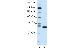 CDK5 antibody (20R-1201) used at 0. (CDK5 anticorps  (N-Term))