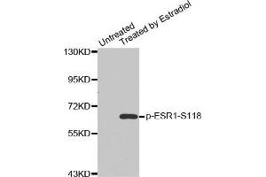 Western blot analysis of extracts from MDA cells using Phospho-ESR1-S118 antibody. (Estrogen Receptor alpha anticorps  (pSer118))