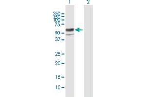 Western Blot analysis of ENTPD8 expression in transfected 293T cell line by ENTPD8 MaxPab polyclonal antibody. (ENTPD8 anticorps  (AA 1-458))