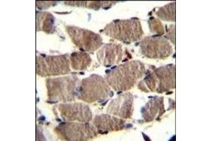 PION Antibody (C-term) (ABIN656412 and ABIN2845706) immunohistochemistry analysis in formalin fixed and paraffin embedded human skeletal muscle followed by peroxidase conjugation of the secondary antibody and DAB staining. (GSAP anticorps  (C-Term))