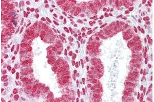 Anti-HOXA11 antibody IHC staining of human uterus. (Homeobox A11 anticorps  (AA 210-259))