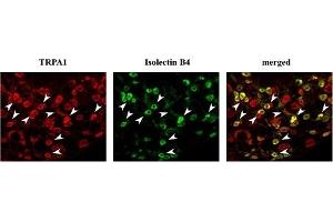 Expression of TRPA1 in rat DRGs.
