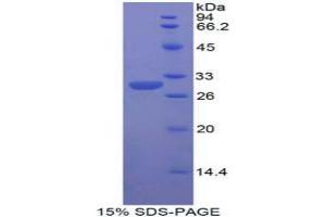 SDS-PAGE analysis of Human dNER Protein. (DNER Protéine)