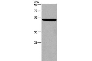 Western Blot analysis of NIH/3T3 cell using KCNN4 Polyclonal Antibody at dilution of 1:450 (KCNN4 anticorps)