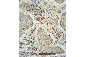 anti-Chromosome 19 Open Reading Frame 50 (C19orf50) (AA 66-95), (Middle Region) antibody
