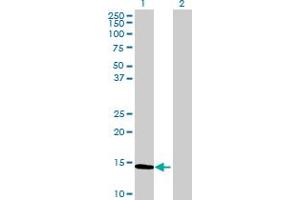 Western Blot analysis of CALCA expression in transfected 293T cell line by CALCA MaxPab polyclonal antibody. (CGRP anticorps  (AA 1-141))