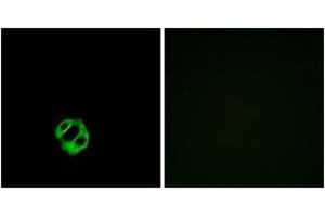 Immunofluorescence analysis of MCF7 cells, using AGTRL1 Antibody. (Apelin Receptor anticorps  (AA 141-190))