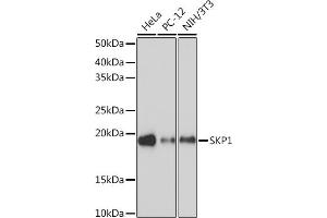 Western blot analysis of extracts of various cell lines, using SKP1 Rabbit mAb (ABIN7270120) at 1:1000 dilution. (SKP1 anticorps)
