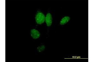 Immunofluorescence of purified MaxPab antibody to IRF2 on HeLa cell. (IRF2 anticorps  (AA 1-349))