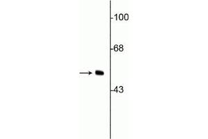 Western blot of HeLa cell lysate showing specific immunolabeling of the ~50 kDa vimentin protein. (Vimentin anticorps)