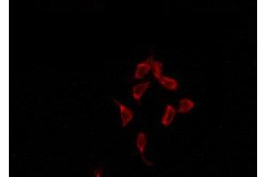 ABIN6274429 staining HepG2 by IF/ICC. (ACRBP anticorps  (Internal Region))