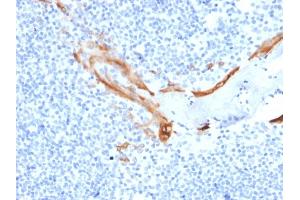 Formalin-fixed, paraffin-embedded human Tonsil stained with Cytokeratin 16 Mouse Monoclonal Antibody (SPM264). (KRT16 anticorps  (C-Term))