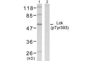 Western blot analysis of extracts from MOLT cells using Lck (phospho-Tyr393) antibody (E011144). (LCK anticorps  (pTyr393))