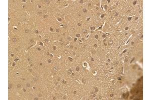 NAA40 Mouse Monoclonal Antibody at 1/100 staining rat brain tissue by IHC-P. (NAA40 anticorps)