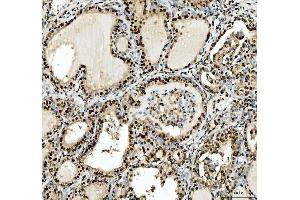 IHC analysis of SFPQ using anti-SFPQ antibody (ABIN7603089). (SFPQ anticorps  (Middle Region))