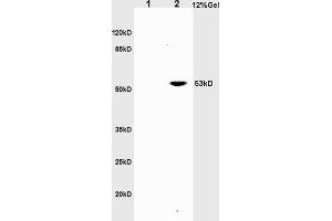 L1 rat brain lysates L2 rat liver lysates probed with Anti CD30/TNFRSF8/CD153 Polyclonal Antibody, Unconjugated (ABIN741090) at 1:200 in 4 °C.