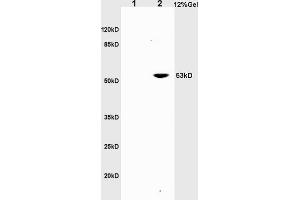 L1 rat brain lysates L2 rat liver lysates probed with Anti CD30/TNFRSF8/CD153 Polyclonal Antibody, Unconjugated (ABIN741090) at 1:200 in 4 °C. (TNFRSF8 anticorps  (AA 131-230))