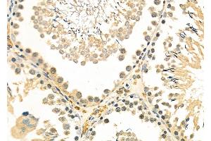 ABIN6263446 and ABIN6276875 at 1/100 staining Rat testis tissue by IHC-P.