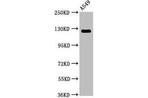 Western Blot Positive WB detected in: A549 whole cell lysate All lanes: RANBP17 antibody at 3. (RANBP17 anticorps  (AA 465-587))