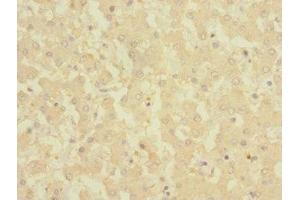 Immunohistochemistry of paraffin-embedded human liver tissue using ABIN7149302 at dilution of 1:100