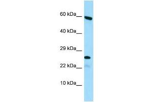 Host: Rabbit Target Name: HGSNAT Sample Type: HepG2 Whole Cell lysates Antibody Dilution: 1.