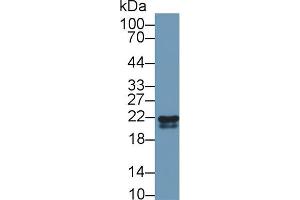 Western blot analysis of Cow Kidney lysate, using Rabbit Anti-Cow RBP4 Antibody (1 µg/ml) and HRP-conjugated Goat Anti-Rabbit antibody (abx400043, 0. (RBP4 anticorps  (AA 19-201))