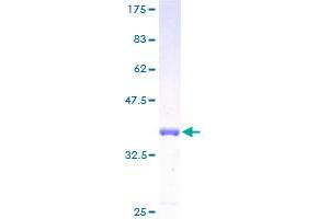 Image no. 1 for Inositol Polyphosphate-4-Phosphatase, Type II, 105kDa (INPP4B) (AA 1-53) protein (GST tag) (ABIN1307949)