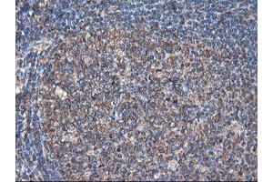 Image no. 4 for anti-Tubulin, alpha-Like 3 (TUBAL3) (AA 150-446) antibody (ABIN1490956)