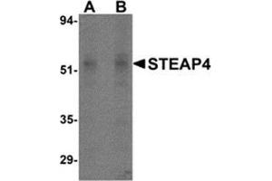 Western blot analysis of STEAP4 in rat liver tissue lysate with STEAP4 antibody at (A) 0. (STEAP4 anticorps  (Center))