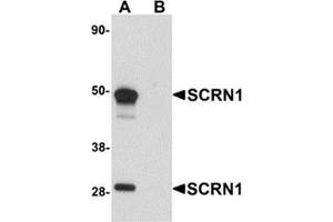 Western blot analysis of SCRN1 in human kidney tissue lysate with SCRN1 antibody at 1 μg/ml in (A) the absence and (B) the presence of blocking peptide.