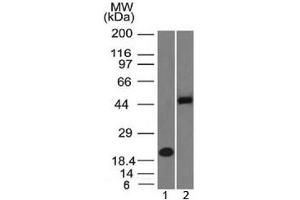 Western blot testing of 1) human partial recombinant protein and 2) human Raji cell lysate with PAX8 antibody (clone PAX8/1492).