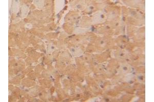 Detection of LDHB in Rat Heart Tissue using Polyclonal Antibody to Lactate Dehydrogenase B (LDHB)